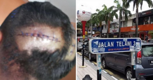 Malaysian Policemen Gets Beaten Up by Gang Members in Bangsar, Suspects Arrested - World Of Buzz 3