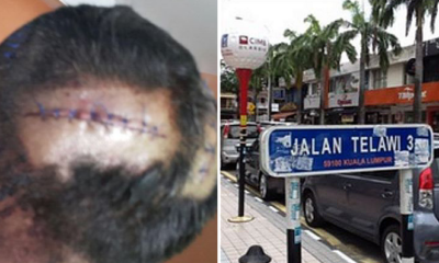 Malaysian Policemen Gets Beaten Up By Gang Members In Bangsar, Suspects Arrested - World Of Buzz 3