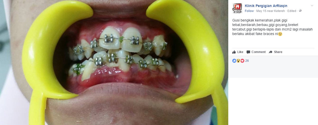 Dentist Shocked to Find His Patient Wearing Fake Braces - World Of Buzz 1