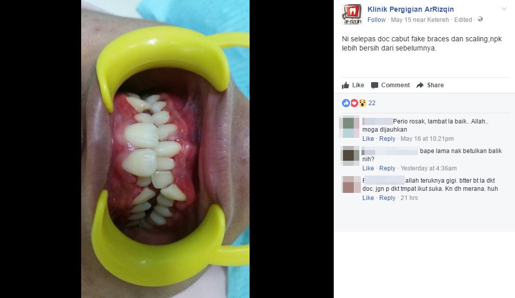 Dentist Shocked to Find His Patient Wearing Fake Braces - World Of Buzz 2