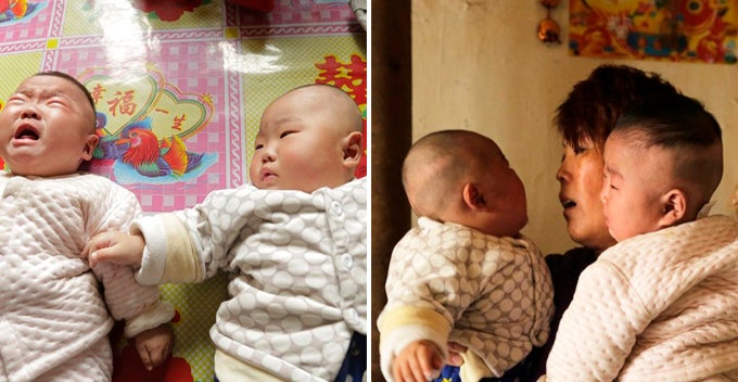 Heartbreaking Moment Poor Chinese Parents Let Twin Brother Baby Draw Lots For Heart Operation World Of Buzz 1