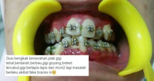 Malaysian Dentist Shocked to Find His Patient Wearing Fake Braces - World Of Buzz
