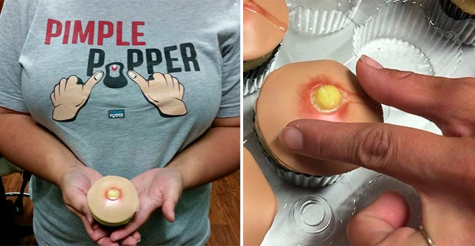 Netizens Getting Mind-Blown By These Pimple Popping Cupcakes - World Of Buzz