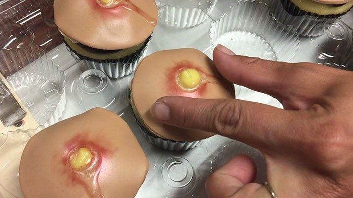 pimple cupcakes dr pimple popper blessed by baking 2