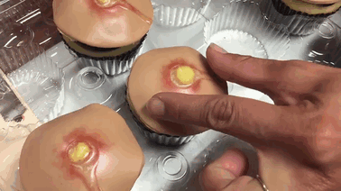 pimple cupcakes dr pimple popper blessed by baking 3