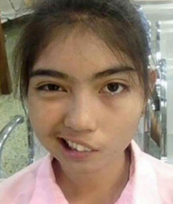Thai Schoolgirl Can Finally Smile Again After Being Assaulted by Teacher - World Of Buzz