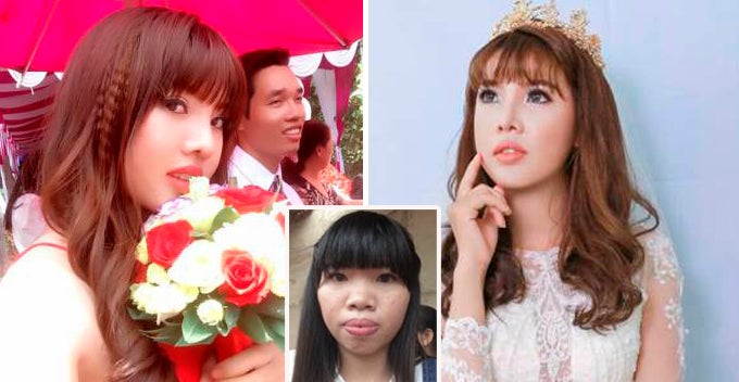 Ugly Vietnamese Lady Deemed Undesirable Transforms Into Gorgeous Lady And Found Rich Husband - World Of Buzz 2