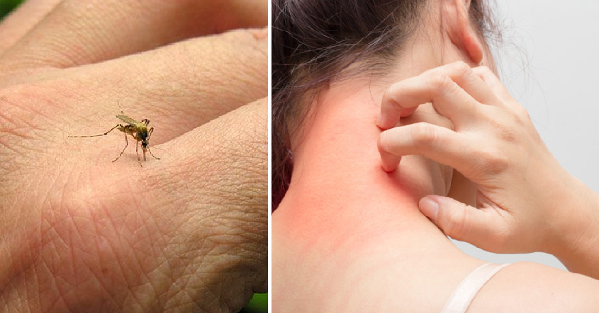 12 Things Malaysians Need To Know About Mosquitoes To Prep For Dengue Season - World Of Buzz 15