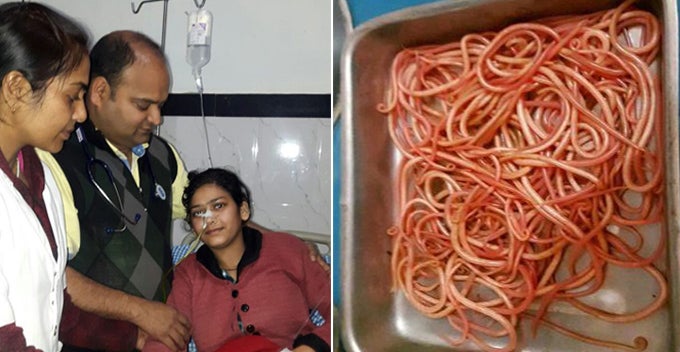 150 Wriggling Worms Removed From Ladys Stomach After Consuming Unhygienic Food That Contains Worm Eggs World Of Buzz 4