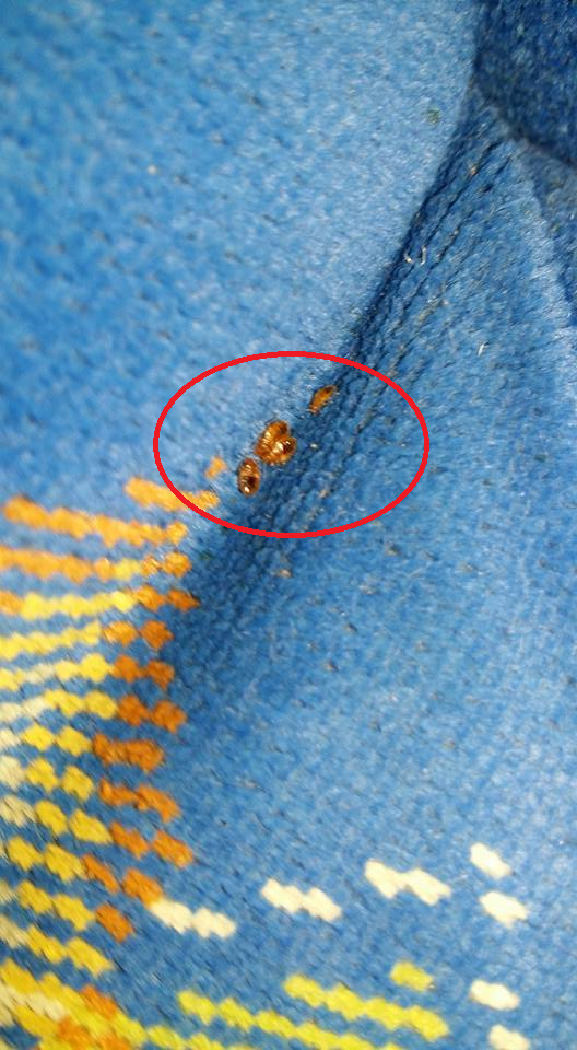 Girl Experiences Terrible Bed Bug Bites In Express Bus From Thailand To Kl - World Of Buzz 1