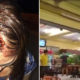 Malaysian Girl Accuses Restaurant Owner Of Injuring Her Head, But Here'S The Twist - World Of Buzz 5
