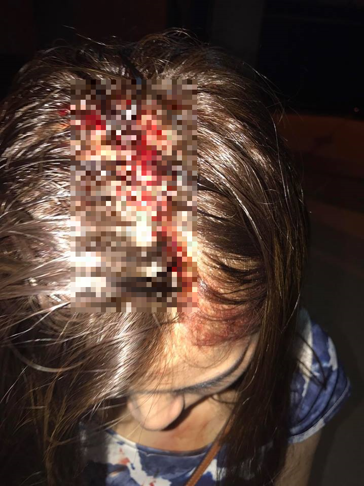 Malaysian Girl Accuses Restaurant Owner Of Injuring Her Head, But Here's The Twist - World Of Buzz