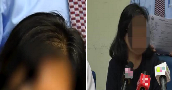 Malaysian Lady Gets Conned Out Of Rm300,000 For Hair Loss Treatment - World Of Buzz 3