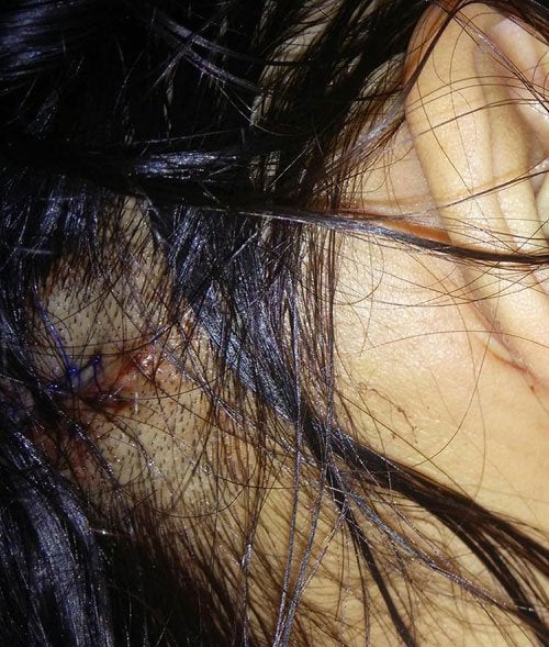 Malaysian Woman Gets Robbed And Kicked By Fake Policemen, Requires 8 Stitches - World Of Buzz