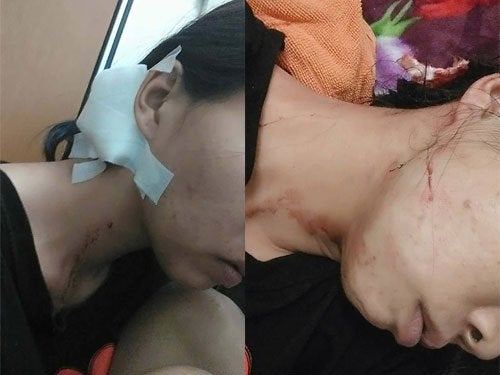 Malaysian Woman Gets Robbed And Kicked By Fake Policemen - World Of Buzz