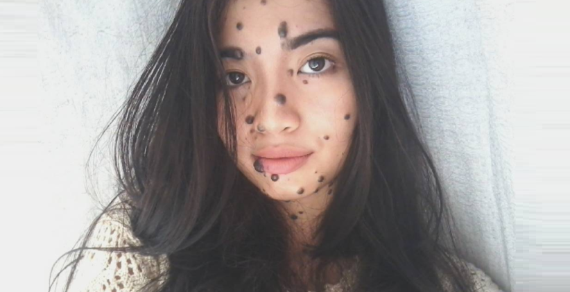 Sabahan Girl With Mole All Over Body Auditions for Miss Universe