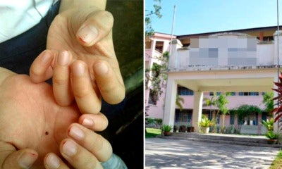 Standard 2 Pupil'S Fingers Bleed After Finger Nails Clipped By Impatient Teacher As Punishment - World Of Buzz