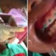 Video Of Thai Schoolboy Installing Braces On His Schoolmates Goes Viral - World Of Buzz 2