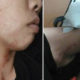 Woman Gets Robbed And Kicked By Fake Policemen In Johor, Requires 8 Stitches - World Of Buzz