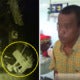 Doctors Found 52 Foreign Objects In Indonesian Man'S Stomach, 18 Were Lighters - World Of Buzz