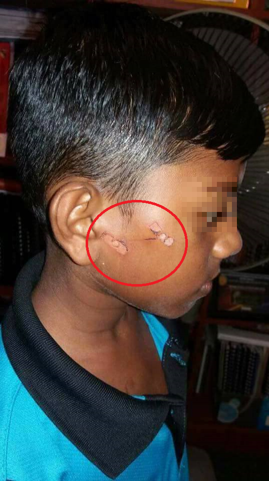 Headmistress Asks Parents of Schoolboy Abused with Heated Metal Sharpener to Pity Teacher - World Of Buzz 1