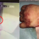Little Girl Plays In Elevator, Suffers Serious Injuries After Hands Slipped Into Cracks - World Of Buzz 3