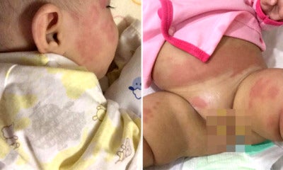 Malaysian Baby Infected With Influenza A Misdiagnosed For Allergy In A Hospital In Kl - World Of Buzz