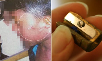 Malaysian Teacher Placed Heated Metal Sharpener On Student'S Cheek As Punishment - World Of Buzz 3