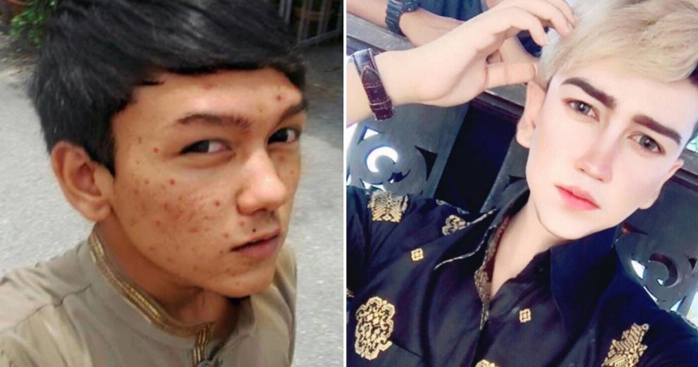 Malaysia's Real-Life 'Anime Character' Upset Over Negative Comments About His Appearance - World Of Buzz 4