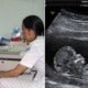 Woman Forced To Have 4 Abortions In 1 Year Because Babies Were Girls, Passes Away - World Of Buzz 3