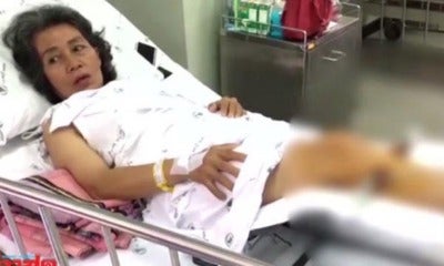 Woman Gets Broken Leg From Thai Massage, Masseur Gives 50 Percent Discount - World Of Buzz
