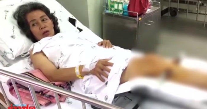 Woman Gets Broken Leg from Thai Massage, Masseur Gives 50 Percent Discount - World Of Buzz