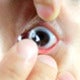 Lady Leaves Contact Lenses In For 5 Months, Turns Blind After Lens 'Merges' With Eyeball - World Of Buzz