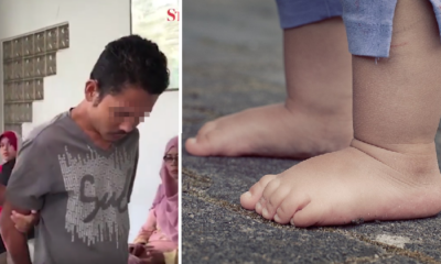 Malaysian Father Made Son Stand On Tarred Road Barefooted Until It Was Burnt - World Of Buzz 2