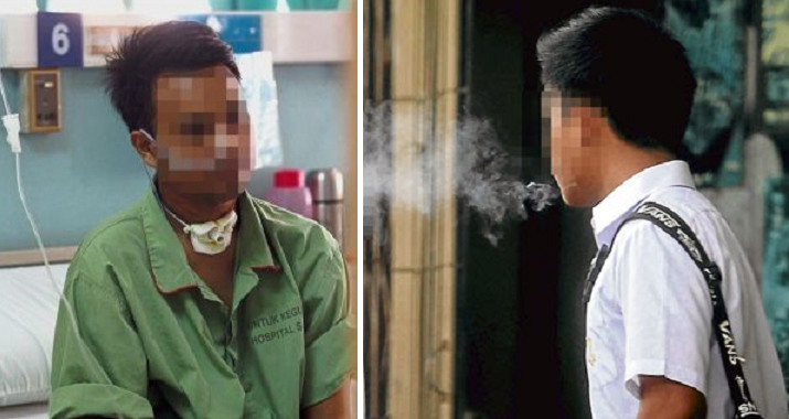 malaysian started smoking at 17 now one of the youngest oral cancer patients world of buzz 8 1