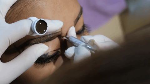 Singapore Lady Goes for Eyebrow Embroidery, Gets Scars from Procedure - World Of Buzz 7