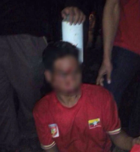 Two Myanmar Football Fans Beaten Up by Malaysians After SEA Games Football Match - World Of Buzz 2