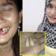 Man Couldn'T Stand Wife'S Nagging, Kicks Her In The Face Until Teeth Fall Out - World Of Buzz