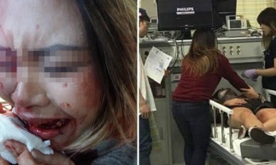 Indonesian Student Brutally Beaten Up By Nightclub Bouncer, Accuses Him Of Racism - World Of Buzz 4