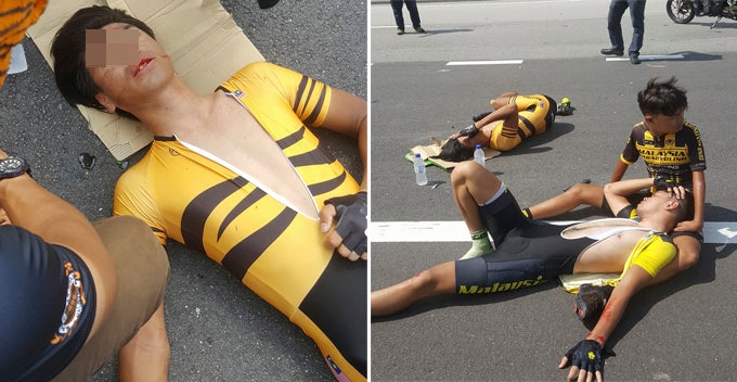 Para-Cyclist Suffer Broken Limbs After Rammed By Pickup Truck In Hit-And-Run - World Of Buzz