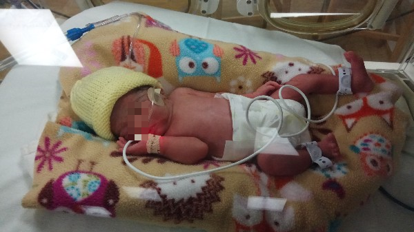 Premature M'sian Baby Born in UK Needs More Than RM500,000 for Treatment - WORLD OF BUZZ 2