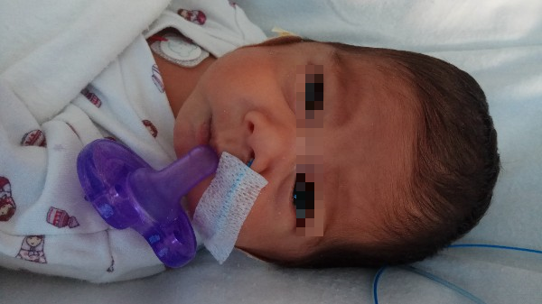Premature M'sian Baby Born in UK Needs More Than RM500,000 for Treatment - WORLD OF BUZZ 3