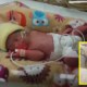 Premature M'Sian Baby Born In Uk Needs More Than Rm500,000 For Treatment - World Of Buzz 5