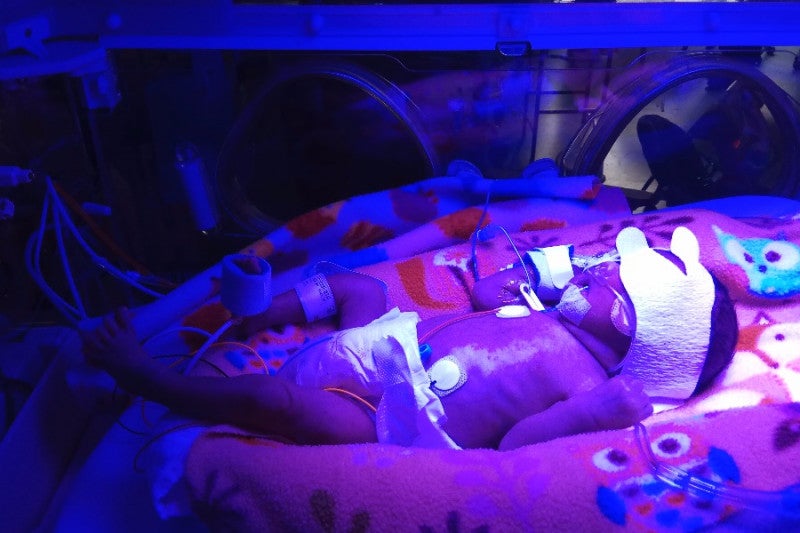 Premature M'sian Baby Born In Uk Needs More Than Rm500,000 For Treatment - World Of Buzz