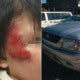 Brave M'Sian Boy Fights With Carjacker After His 2 Sisters Jump Off The Moving Truck - World Of Buzz