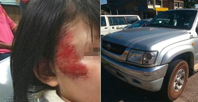 Brave M'Sian Boy Fights With Carjacker After His 2 Sisters Jump Off The Moving Truck - World Of Buzz
