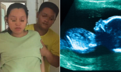 Couple Mistakenly Aborts Baby Boy, Causes Mother To Suffer From Infertility - World Of Buzz 5