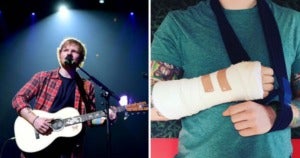 Ed Sheeran Breaks Guitar-Playing Arm, Asia Tour May Be Affected - WORLD OF BUZZ 1