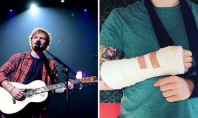 Ed Sheeran Breaks Guitar-Playing Arm, Asia Tour May Be Affected - World Of Buzz 1