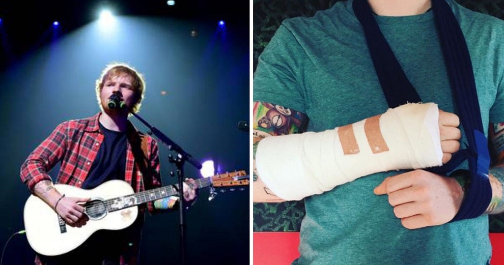 Ed Sheeran Breaks Guitar-Playing Arm, Asia Tour May Be Affected - World Of Buzz 1